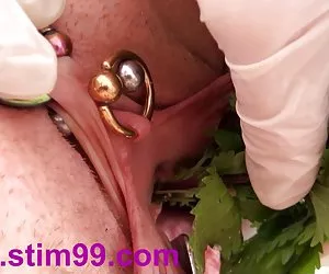 荨麻尿道插入荨麻